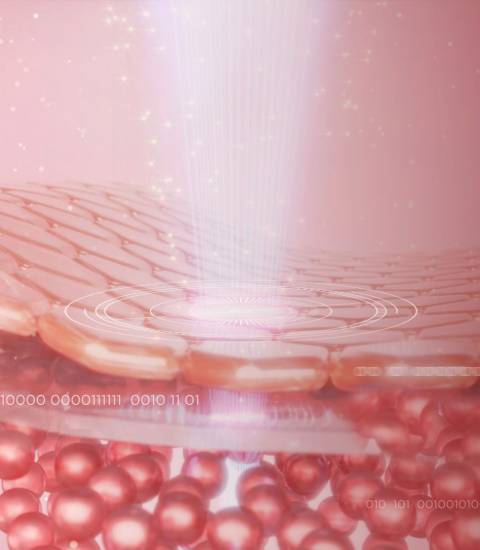 Die Behandlung von Akne und Akne inversa mit der neuen »lAight-Therapie«